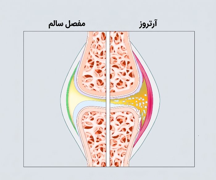 تفاوت مفصل دچار آرتروز و مفصل سالم سگ